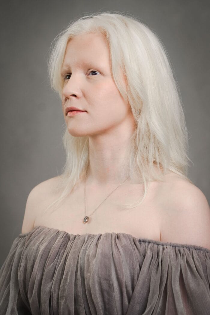 Gelmių akys – Paveikslėlis 6