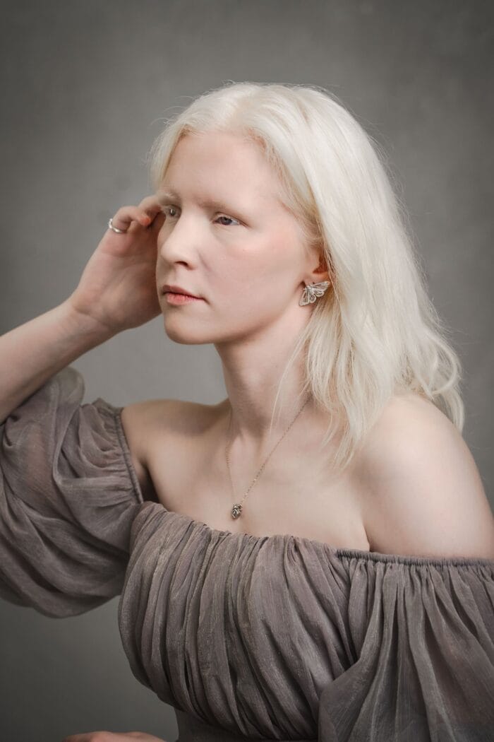 Gelmių akys – Paveikslėlis 2